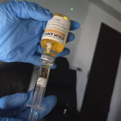 Microneedling con PDRN de salmón