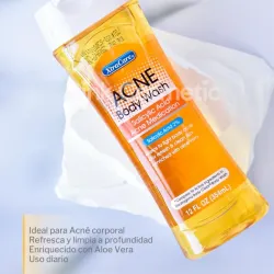 Gel corporal para tratar el acné. Ácido salicílico